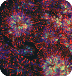Les neurones de cellules souches établissent les bonnes connexions