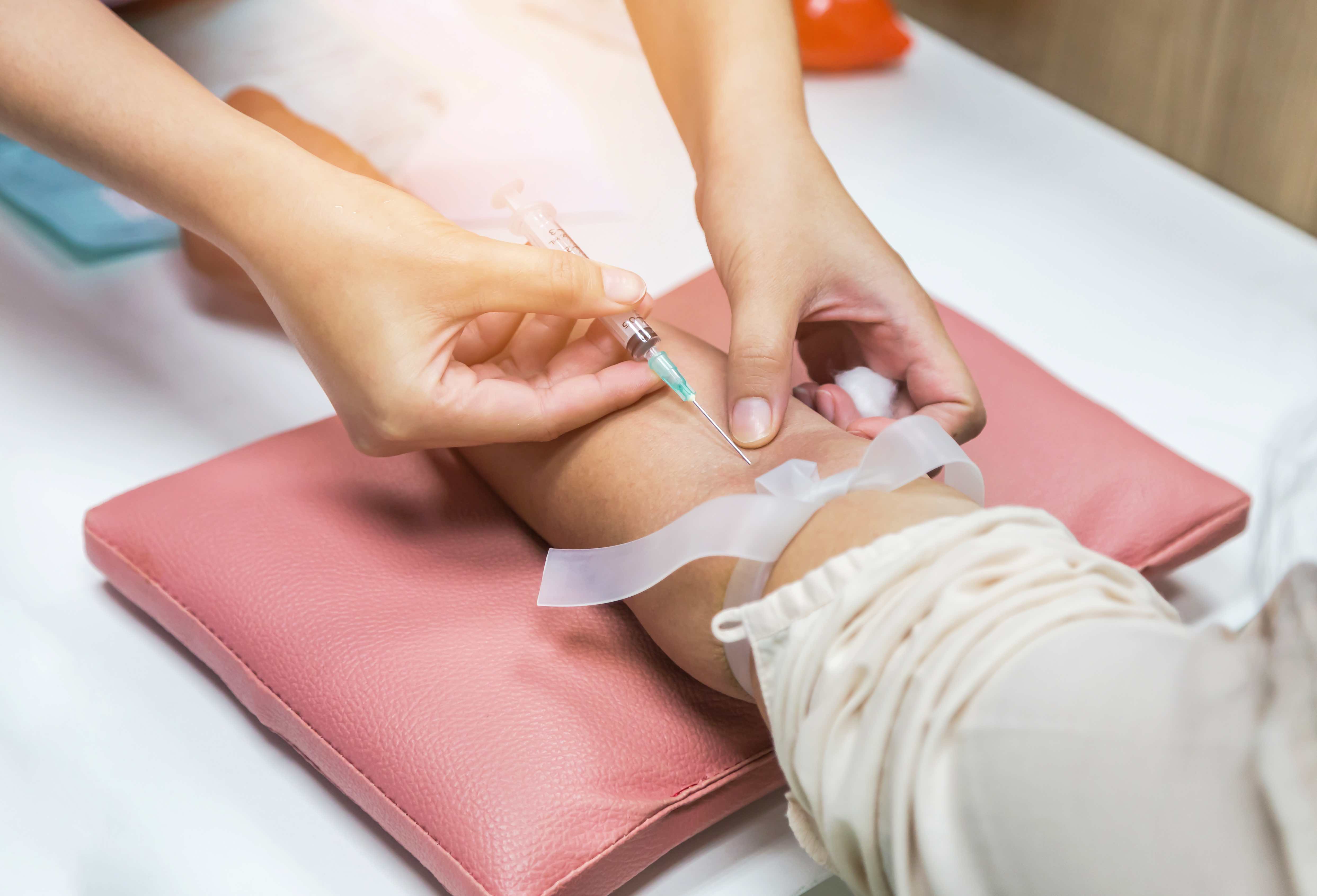 Contrairement aux biomarqueurs précédents pour la MH, cette nouvelle découverte peut être réalisée à partir d'un simple échantillon de sang. 